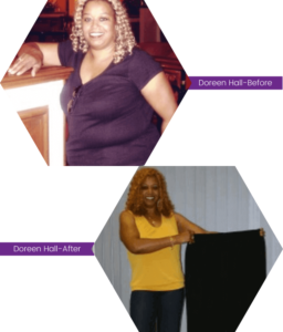 Doreen Hall before and after Indy Hypnosis services