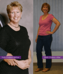 Patti Chobra before and after Indy Hypnosis services